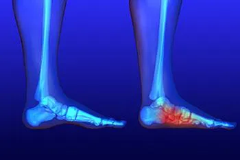 Deformity correction. image 2